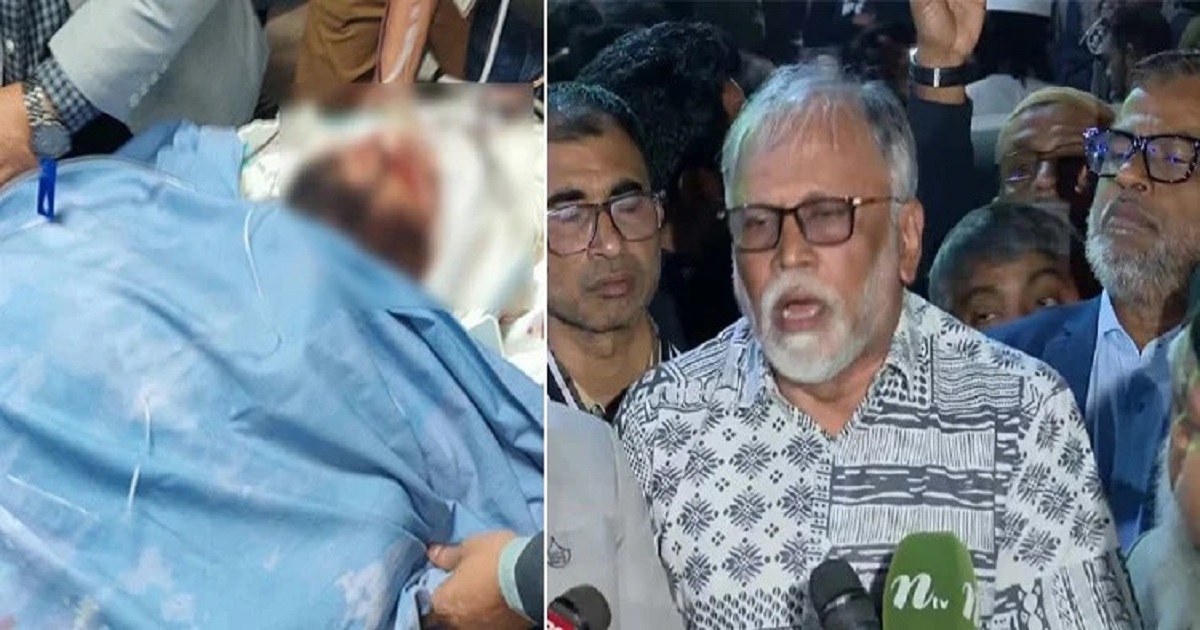 ৭২ ঘণ্টা অত্যন্ত সংকটাপন্ন, হাদির ব্রেন স্টেম ক্ষতিগ্রস্ত
