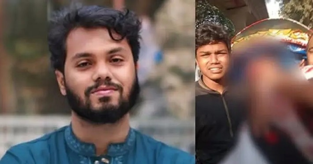 ওসমান হাদির অবস্থা আশঙ্কাজনক : মেডিকেল বোর্ড