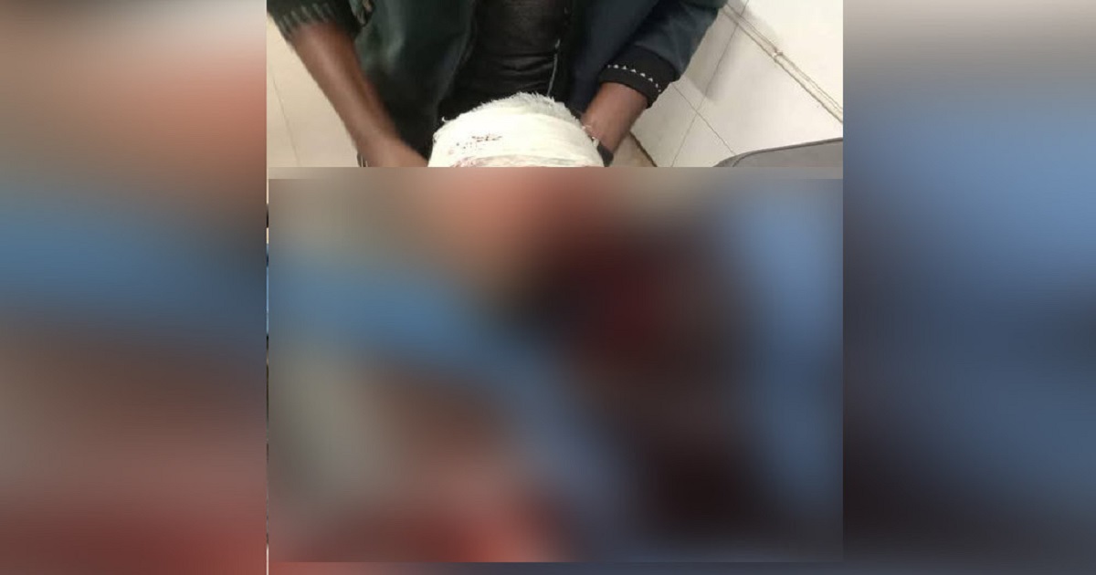 প্রকাশ্যে এনসিপি নেতাকে গুলি