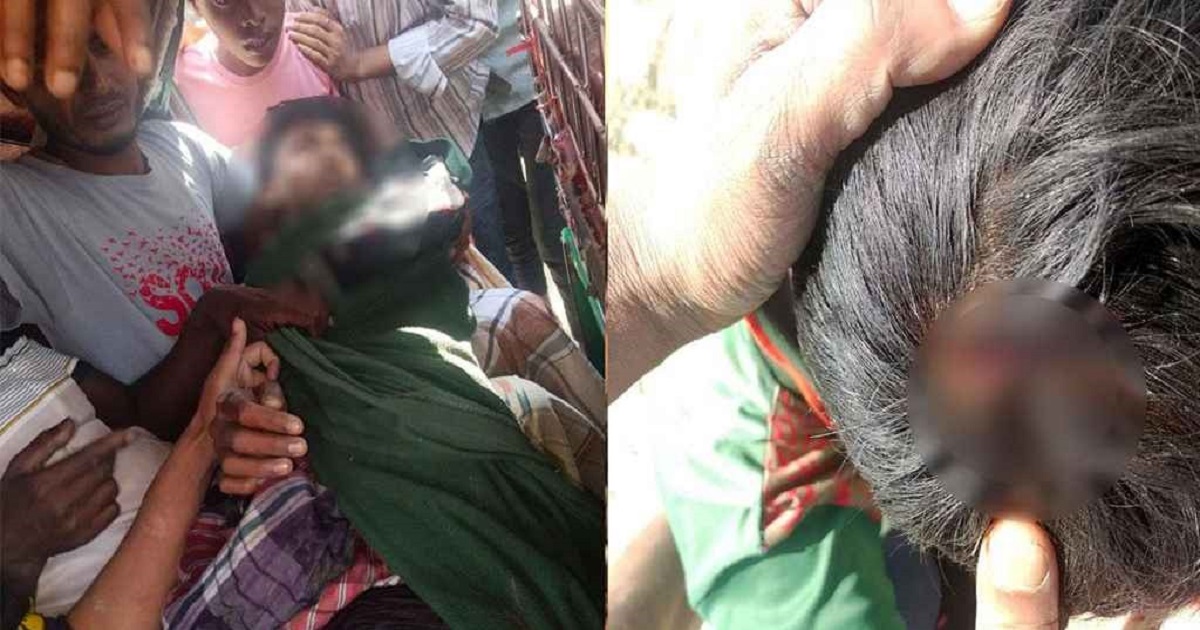 মিয়ানমার থেকে ছোঁড়া গুলিতে টেকনাফে ২ কিশোর আহত