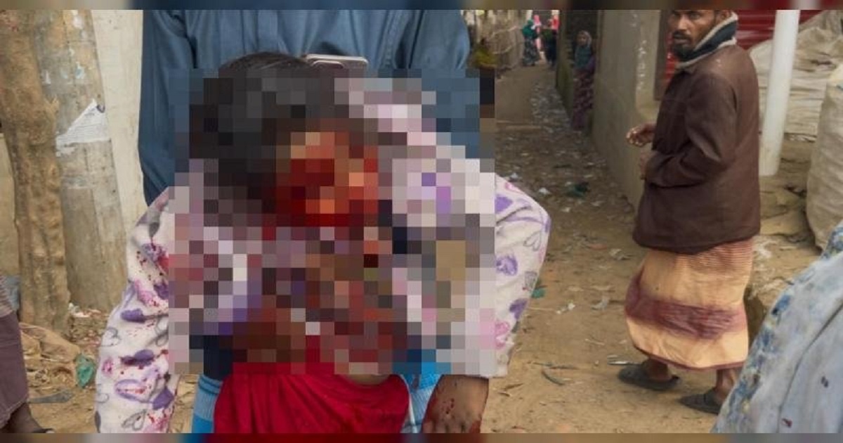 টেকনাফ সীমান্তে গুলিবিদ্ধ শিশু হুজাইফার মৃত্যু