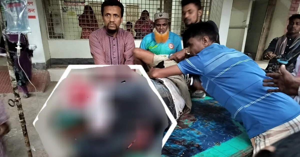 চলন্ত ট্রেন থেকে নামতে গিয়ে পুলিশ সদস্যের দুই পা বিচ্ছিন্ন