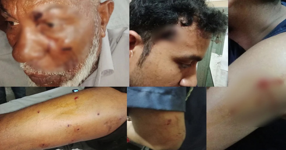 পদ্মা নদীতে টহলকালে পুলিশের ওপর হামলা, ওসিসহ ৫ পুলিশ সদস্য গুলিবিদ্ধ