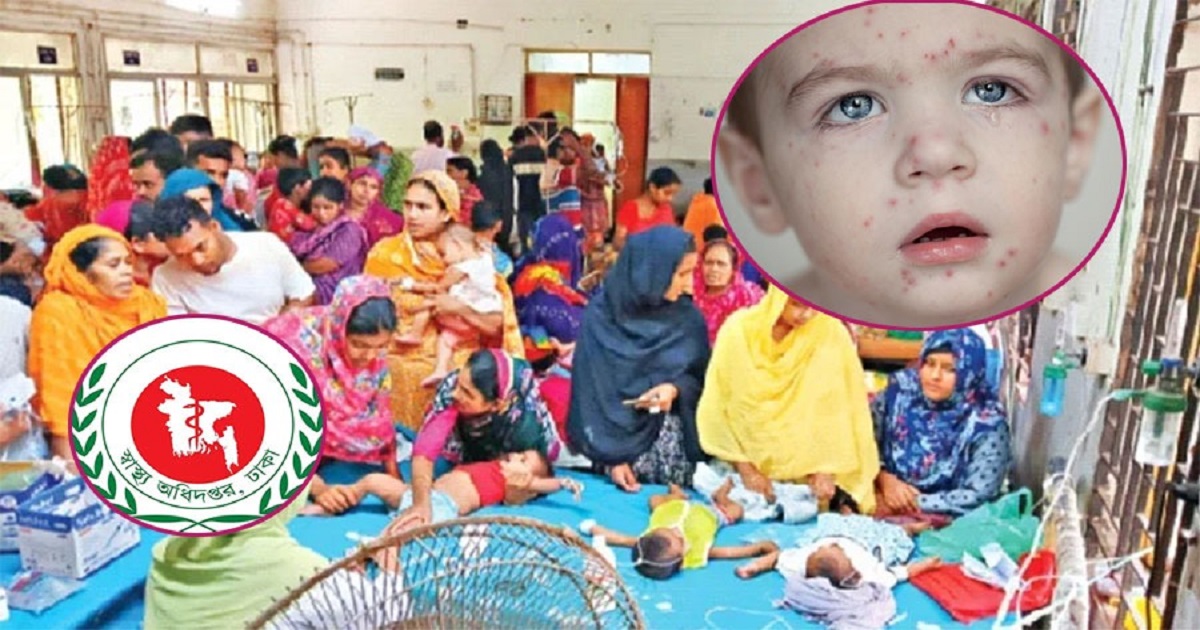 হামের থাবায় ৮৯ দিনে ৬৪৩ মৃত্যু